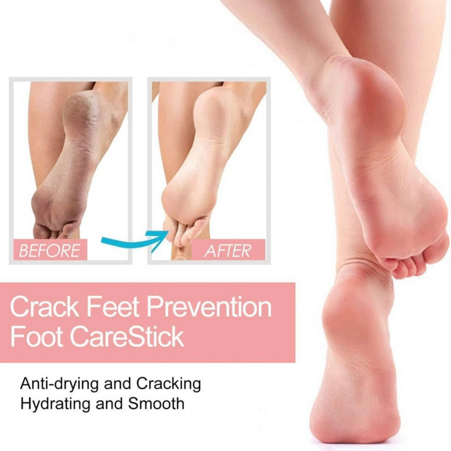 Ezvara™FootRestore Balm