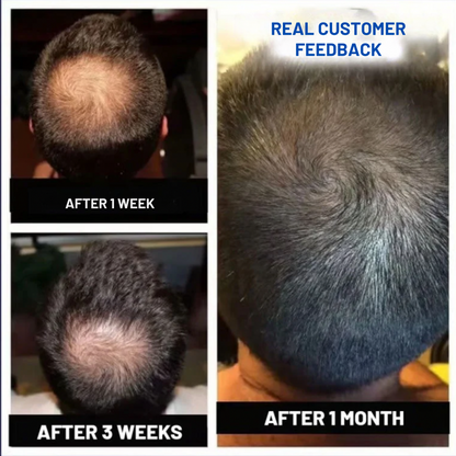 Ezvara™ Hair Growth Roll-On