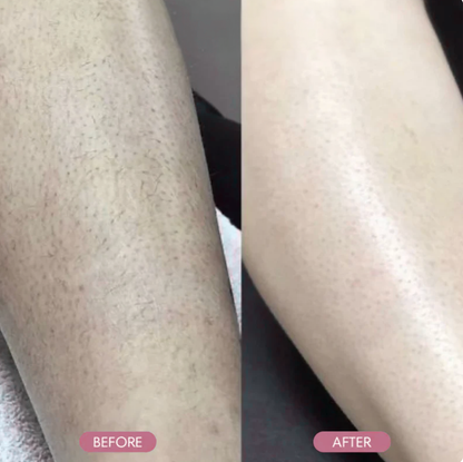 Ezvara™ Hair Reduction Oil