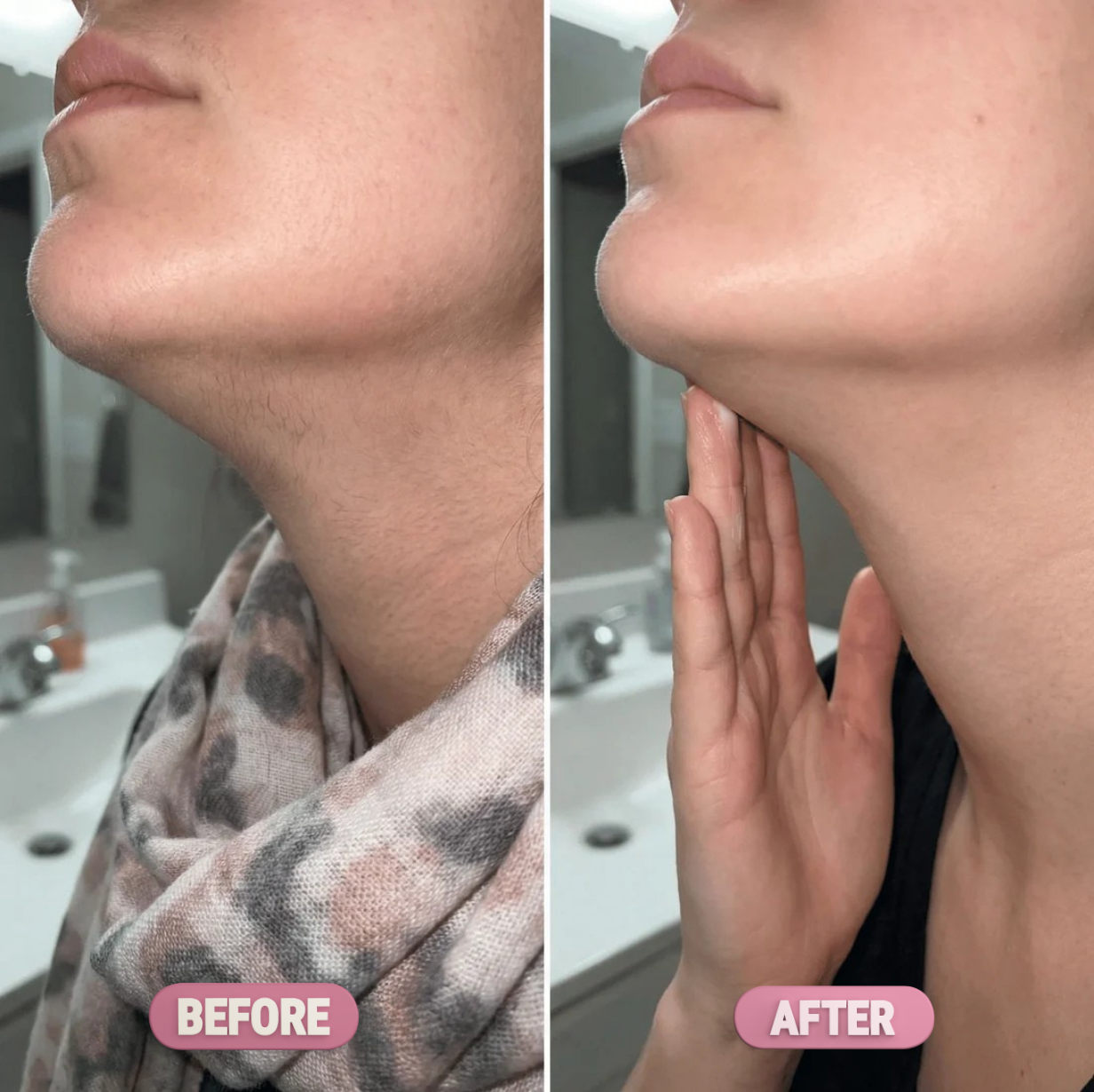 Ezvara™ Hair Reduction Oil