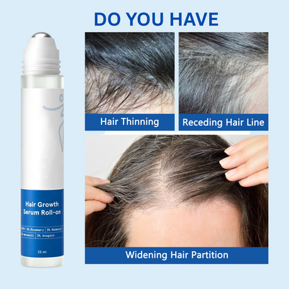 Ezvara™ Hair Growth Roll-On