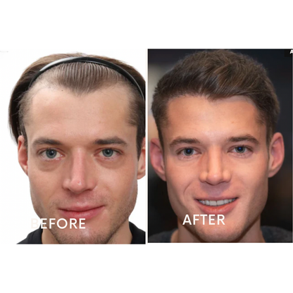 Ezvara™ Hair Growth Roll-On